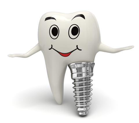 Why-get-dental-implants2