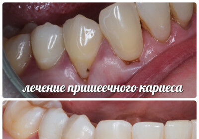 Работа доктора Ершова Юлия Владимировна