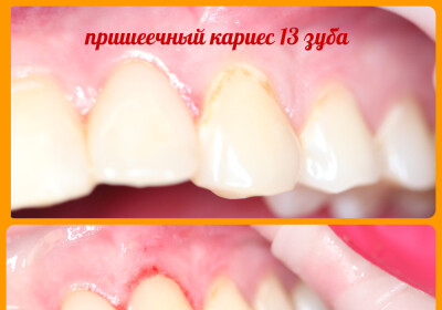 Работа доктора Ершова Юлия Владимировна
